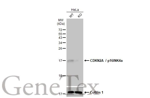 Anti-CDKN2A / p16INK4a antibody (GTX135120) | GeneTex