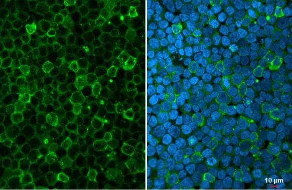 Myeloperoxidase antibody detects Myeloperoxidase protein at vesicle by immunofluorescent analysis. Sample: HL-60 cells were fixed in 4% paraformaldehyde at RT for 15 min. Green: Myeloperoxidase stained by Myeloperoxidase antibody (GTX135126) diluted at 1:500. Blue: Hoechst 33342 staining.