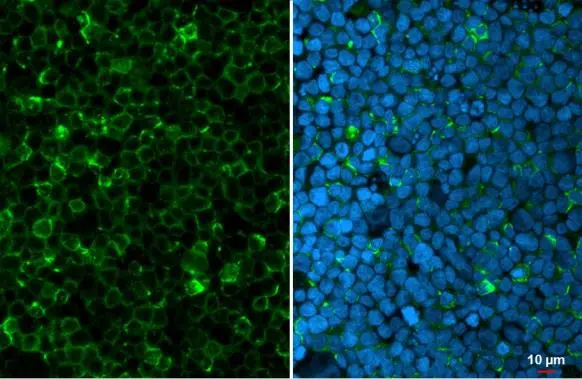 Myeloperoxidase antibody detects Myeloperoxidase protein at vesicle by immunofluorescent analysis. Sample: HL-60 cells were fixed in 4% paraformaldehyde at RT for 15 min. Green: Myeloperoxidase stained by Myeloperoxidase antibody (GTX135127) diluted at 1:500. Blue: Hoechst 33342 staining.