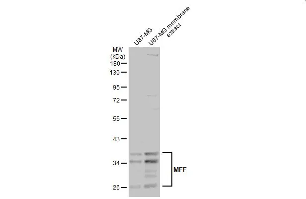 U87-MG whole cell and membrane extracts (30 μg) were separated by 10% SDS-PAGE, and the membrane was blotted with MFF antibody (GTX135140) diluted at 1:1000. The HRP-conjugated anti-rabbit IgG antibody (GTX213110-01) was used to detect the primary antibody.