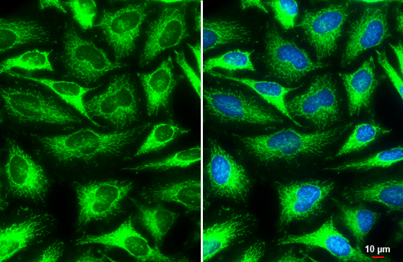 MFF antibody detects MFF protein at mitochondria by immunofluorescent analysis. Sample: HeLa cells were fixed in ice-cold MeOH for 5 min. Green: MFF stained by MFF antibody (GTX135140) diluted at 1:500. Blue: Fluoroshield with DAPI (GTX30920). Scale bar= 10 μm.