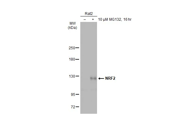 Untreated (–) and treated (+) Rat2 whole cell extracts (30 μg) were separated by 5% SDS-PAGE, and the membrane was blotted with NRF2 antibody (GTX135165) diluted at 1:1000. The HRP-conjugated anti-rabbit IgG antibody (GTX213110-01) was used to detect the primary antibody, and the signal was developed with Trident ECL plus-Enhanced. Untreated (–) and treated (+) Rat2 whole cell extracts (30 μg) were separated by 5% SDS-PAGE, and the membrane was blotted with NRF2 antibody (GTX135165) diluted at 1:1000. The HRP-conjugated anti-rabbit IgG antibody (GTX213110-01) was used to detect the primary antibody, and the signal was developed with Trident ECL plus-Enhanced.