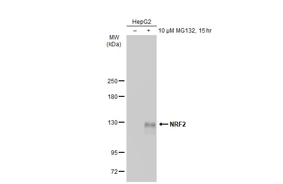 Untreated (–) and treated (+) HepG2 whole cell extracts (30 μg) were separated by 5% SDS-PAGE, and the membrane was blotted with NRF2 antibody (GTX135165) diluted at 1:1000. The HRP-conjugated anti-rabbit IgG antibody (GTX213110-01) was used to detect the primary antibody. Untreated (–) and treated (+) HepG2 whole cell extracts (30 μg) were separated by 5% SDS-PAGE, and the membrane was blotted with NRF2 antibody (GTX135165) diluted at 1:1000. The HRP-conjugated anti-rabbit IgG antibody (GTX213110-01) was used to detect the primary antibody.