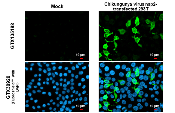 DNA / SCATTER THE BRAIN ジャパメタ VIRUS Anti-Chikungunya virus nsP2 antibody (GTX135188) | GeneTex