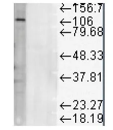 WB analysis of rat liver microsome lysates using GTX13523 LAMP1 antibody [Ly1C6].