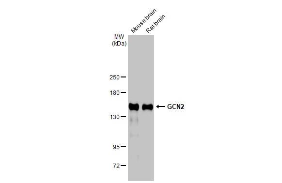 Various tissue extracts (50 μg) were separated by 5% SDS-PAGE, and the membrane was blotted with GCN2 antibody (GTX135252) diluted at 1:20000. The HRP-conjugated anti-rabbit IgG antibody (GTX213110-01) was used to detect the primary antibody.