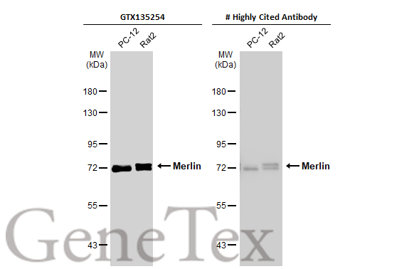 Various whole cell extracts (30 μg) were separated by 7.5% SDS-PAGE, and the membranes were blotted with Merlin antibody (GTX135254) diluted at 1:5000 and competitor's antibody (# Highly Cited Antibody) diluted at 1:5000. The HRP-conjugated anti-rabbit IgG antibody (GTX213110-01) was used to detect the primary antibody. *The competitor is not affiliated with GeneTex and does not endorse this product.