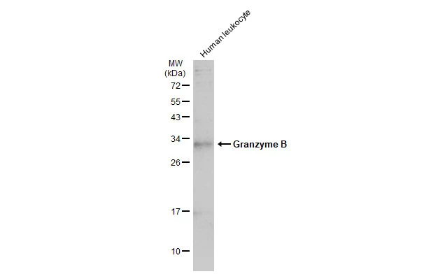 Human leukocyte (30 μg) was separated by 12% SDS-PAGE, and the membrane was blotted with Granzyme B antibody (GTX135274) diluted at 1:1000. The HRP-conjugated anti-rabbit IgG antibody (GTX213110-01) was used to detect the primary antibody, and the signal was developed with Trident ECL plus-Enhanced.