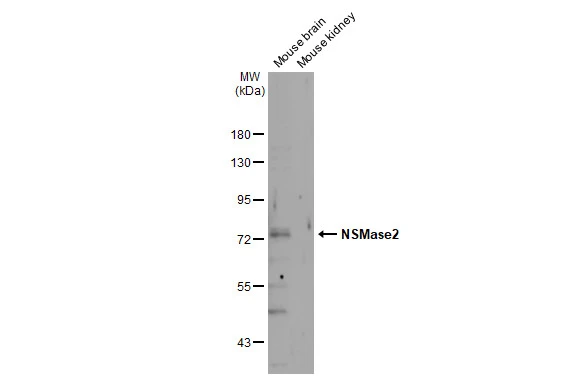 NSMase2 antibody