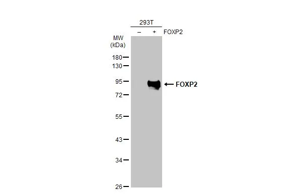 Non-transfected (–) and transfected (+) 293T whole cell extracts (30 μg) were separated by 10% SDS-PAGE, and the membrane was blotted with FOXP2 antibody (GTX135285) diluted at 1:5000. The HRP-conjugated anti-rabbit IgG antibody (GTX213110-01) was used to detect the primary antibody.
