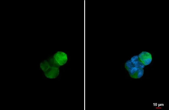 CD9 antibody detects CD9 protein at cell membrane by immunofluorescent analysis. Sample: K562 cells were fixed in 4% paraformaldehyde at RT for 15 min. Green: CD9 stained by CD9 antibody (GTX135296) diluted at 1:500.