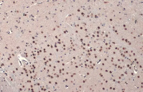 FOXP2 antibody detects FOXP2 protein at nucleus by immunohistochemical analysis. Sample: Paraffin-embedded mouse brain. FOXP2 stained by FOXP2 antibody (GTX135298) diluted at 1:500. Antigen Retrieval: Citrate buffer, pH 6.0, 15 min