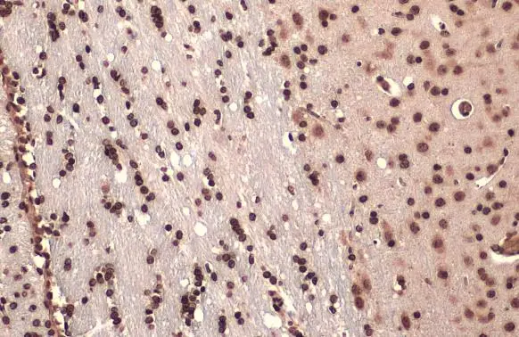 FOXP2 antibody detects FOXP2 protein at nucleus by immunohistochemical analysis. Sample: Paraffin-embedded rat brain. FOXP2 stained by FOXP2 antibody (GTX135298) diluted at 1:500. Antigen Retrieval: Citrate buffer, pH 6.0, 15 min