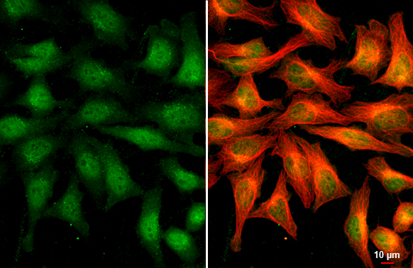 Rag A antibody detects Rag A protein at cytoplasm and nucleus by immunofluorescent analysis. Sample: HeLa cells were fixed in 4% paraformaldehyde at RT for 15 min. Green: Rag A stained by Rag A antibody (GTX135318) diluted at 1:500. Red: alpha Tubulin, a cytoskeleton marker, stained by alpha Tubulin antibody [GT114] (GTX628802) diluted at 1:1000. Scale bar= 10μm.