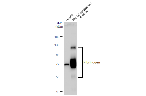 HepG2 whole cell extract and conditioned medium (30 μg) were separated by 7.5% SDS-PAGE, and the membrane was blotted with Fibrinogen antibody (GTX135332) diluted at 1:20000. The HRP-conjugated anti-rabbit IgG antibody (GTX213110-01) was used to detect the primary antibody.