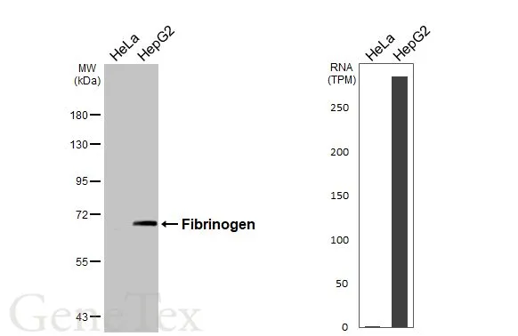 Various whole cell extracts (30 μg) were separated by 7.5% SDS-PAGE, and the membrane was blotted with Fibrinogen antibody (GTX135332) diluted at 1:1000. The HRP-conjugated anti-rabbit IgG antibody (GTX213110-01) was used to detect the primary antibody. Corresponding RNA expression data are based on Human Protein Atlas program.