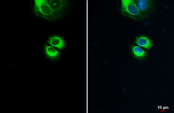 Anterior Gradient 2 antibody