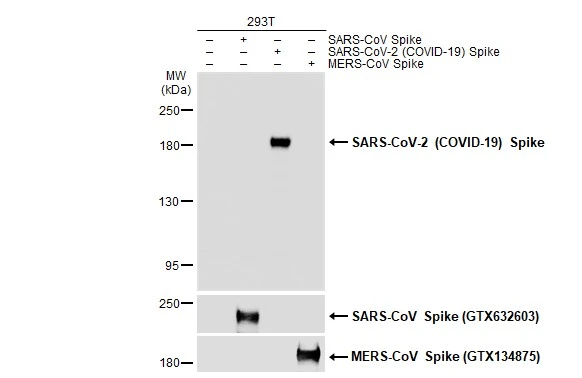 Anti-SARS-CoV-2 (COVID-19) Spike antibody (GTX135356) | GeneTex Anti-SARS-CoV-2 (COVID-19) Spike antibody (GTX135356) | GeneTex