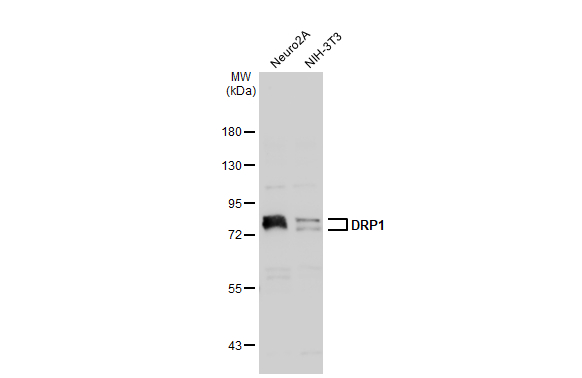 Various whole cell extracts (30 μg) were separated by 7.5% SDS-PAGE, and the membrane was blotted with DRP1 antibody (GTX135364) diluted at 1:2000. The HRP-conjugated anti-rabbit IgG antibody (GTX213110-01) was used to detect the primary antibody.