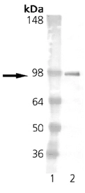 Western blot analysis of ESR1:  Lane 1: MWM  Lane 2: Estrogen Receptor 1 GST-tagged ER1 protein control runs at 92 kDa