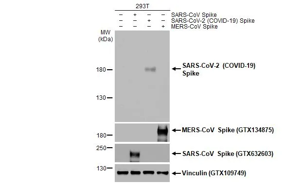 Anti-SARS-CoV-2 (COVID-19) Spike RBD antibody (GTX135385