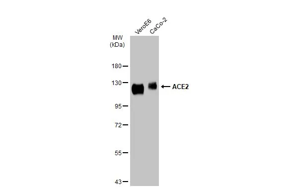 Various whole cell extracts (30 μg) were separated by 7.5% SDS-PAGE, and the membrane was blotted with ACE2 antibody (GTX135403) diluted at 1:1000. The HRP-conjugated anti-rabbit IgG antibody (GTX213110-01) was used to detect the primary antibody.