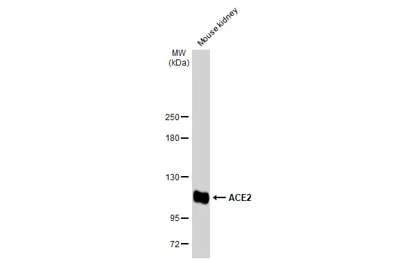Mouse tissue extract (50 μg) was separated by 5% SDS-PAGE, and the membrane was blotted with ACE2 antibody (GTX135406) diluted at 1:1000. The HRP-conjugated anti-rabbit IgG antibody (GTX213110-01) was used to detect the primary antibody.