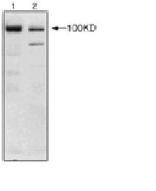 Western Blot analysis using Nucleolin [4E2] antibody (GTX13541) on HL60 (1) and ZR-75 (2) cell extracts