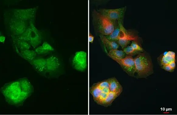 Apolipoprotein E (R136S Mutant) antibody detects Apolipoprotein E (R136S Mutant) protein at cytoplasm by immunofluorescent analysis. Sample: HepG2 cells were fixed in 4% paraformaldehyde at RT for 15 min. Green: Apolipoprotein E (R136S Mutant) stained by Apolipoprotein E (R136S Mutant) antibody (GTX135410) diluted at 1:500. Red: alpha Tubulin, a cytoskeleton marker, stained by alpha Tubulin antibody [GT114] (GTX628802) diluted at 1:1000. Blue: Fluoroshield with DAPI (GTX30920).