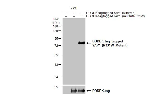 Non-transfected (–) and transfected (+) 293T whole cell extracts (30 μg) were separated by 10% SDS-PAGE, and the membrane was blotted with YAP1 (R331W Mutant) antibody (GTX135411) diluted at 1:5000. The HRP-conjugated anti-rabbit IgG antibody (GTX213110-01) was used to detect the primary antibody.