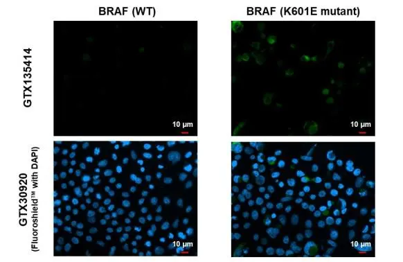 B-Raf (K601E Mutant) antibody detects B-Raf (K601E Mutant) protein by immunofluorescent analysis. Sample: WT transfected and mutant transfected 293T cells were fixed in 4% paraformaldehyde at RT for 15 min. Green: B-Raf (K601E Mutant) stained by B-Raf (K601E Mutant) antibody (GTX135414) diluted at 1:500. Blue: Fluoroshield with DAPI (GTX30920).