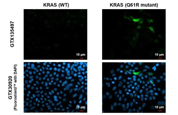 RAS (Q61R Mutant) antibody detects RAS (Q61R Mutant) protein by immunofluorescent analysis. Sample: RAS (WT) and RAS (Q61R Mutant) transfected 293T cells were fixed in 4% paraformaldehyde at RT for 15 min. Green: RAS (Q61R Mutant) stained by RAS (Q61R Mutant) antibody (GTX135497) diluted at 1:500. Blue: Fluoroshield with DAPI (GTX30920).