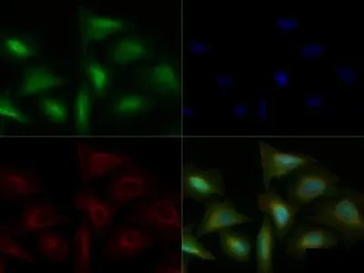 ICC/IF analysis of U2OS cells using GTX13556 TLR4 antibody. Green : primary antibody Red : Tubulin Blue : DAPI Dilution : 1:50 Fixation : 10% formalin Permibilization : 0.5% Triton-X100