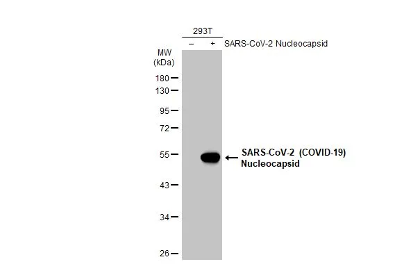 Non-transfected (-) and transfected (+) 293T whole cell extracts (30 microg) were separated by 10% SDS-PAGE, and the membrane was blotted with SARS-CoV-2 (COVID-19) nucleocapsid antibody (GTX135570) diluted at 1:5000. The HRP-conjugated anti-rabbit IgG antibody (GTX213110-01) was used to detect the primary antibody.