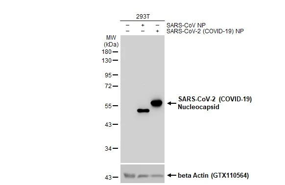 Non-transfected (-) and transfected (+) 293T whole cell extracts (30 microg) were separated by 10% SDS-PAGE, and the membrane was blotted with SARS-CoV-2 (COVID-19) Nucleocapsid antibody (GTX135570) diluted at 1:5000. The HRP-conjugated anti-rabbit IgG antibody (GTX213110-01) was used to detect the primary antibody.