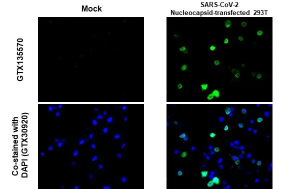 SARS-CoV-2 (COVID-19) Nucleocapsid antibody detects SARS-CoV-2 (COVID-19) Nucleocapsid protein at cytoplasm by immunohistochemical analysis. Sample: Mock (GTX435670) and SARS-CoV-2 (COVID-19) Nucleocapsid transfected 293T cell FFPE Cell Pellet Block (GTX435641). Green: SARS-CoV-2 (COVID-19) Nucleocapsid stained by SARS-CoV-2 (COVID-19) Nucleocapsid antibody (GTX135570) diluted at 1:1000. Blue: Fluoroshield with DAPI (GTX30920). Antigen Retrieval: Citrate buffer, pH 6.0, 15 min