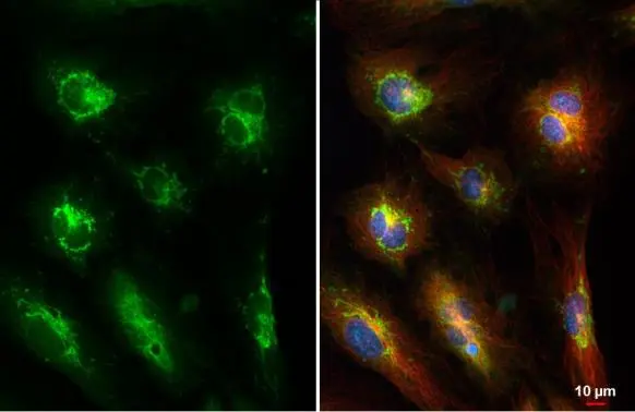 Pentraxin 3 antibody detects Pentraxin 3 protein at mitochondria by immunofluorescent analysis. Sample: HUVEC cells were fixed in 4% paraformaldehyde at RT for 15 min. Green: Pentraxin 3 stained by Pentraxin 3 antibody (GTX135596) diluted at 1:500. Red: alpha Tubulin, a cytoskeleton marker, stained by alpha Tubulin antibody [GT114] (GTX628802) diluted at 1:1000. Blue: Fluoroshield with DAPI (GTX30920).