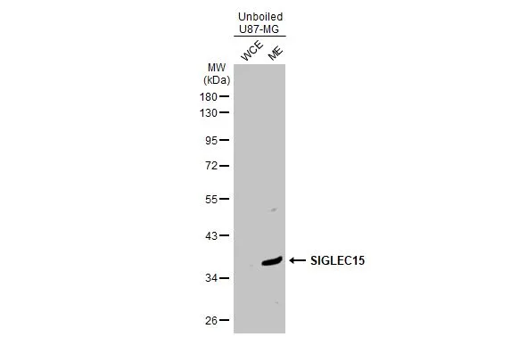 Unboiled U87-MG cell extracts (30 microg) were separated by 10% SDS-PAGE, and the membrane was blotted with SIGLEC15 antibody (GTX135600) diluted at 1:500. The HRP-conjugated anti-rabbit IgG antibody (GTX213110-01) was used to detect the primary antibody.