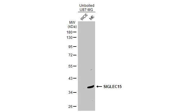 Unboiled U87-MG cell extracts (30 μg) were separated by 10% SDS-PAGE, and the membrane was blotted with SIGLEC15 antibody (GTX135600) diluted at 1:500. The HRP-conjugated anti-rabbit IgG antibody (GTX213110-01) was used to detect the primary antibody.