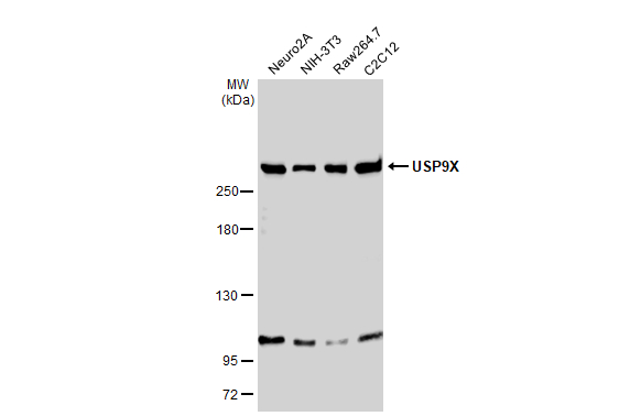 Various whole cell extracts (30 μg) were separated by 5% SDS-PAGE, and the membrane was blotted with USP9X antibody (GTX135634) diluted at 1:1000. The HRP-conjugated anti-rabbit IgG antibody (GTX213110-01) was used to detect the primary antibody.
