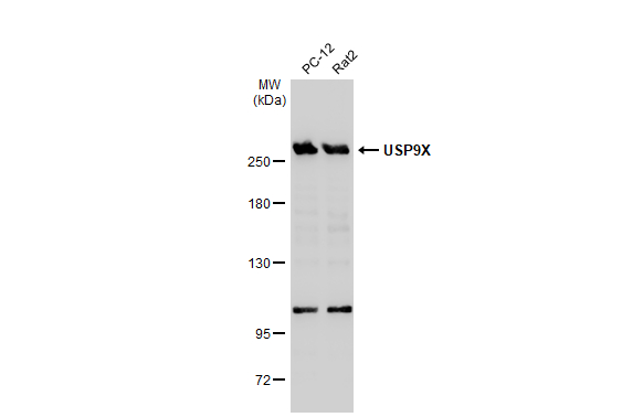Various whole cell extracts (30 μg) were separated by 5% SDS-PAGE, and the membrane was blotted with USP9X antibody (GTX135634) diluted at 1:1000. The HRP-conjugated anti-rabbit IgG antibody (GTX213110-01) was used to detect the primary antibody.
