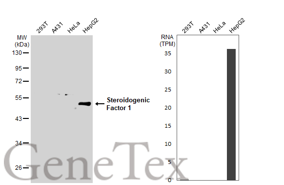 Various whole cell extracts (30 μg) were separated by 10% SDS-PAGE, and the membrane was blotted with Steroidogenic Factor 1 antibody (GTX135635) diluted at 1:2000. The HRP-conjugated anti-rabbit IgG antibody (GTX213110-01) was used to detect the primary antibody. Corresponding RNA expression data for the same cell lines are based on Human Protein Atlas program.
