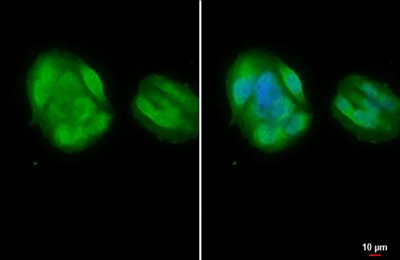 Steroidogenic Factor 1 antibody detects Steroidogenic Factor 1 protein at nucleus by immunofluorescent analysis. Sample: HepG2 cells were fixed in 4% paraformaldehyde at RT for 15 min. Green: Steroidogenic Factor 1 stained by Steroidogenic Factor 1 antibody (GTX135635) diluted at 1:200.