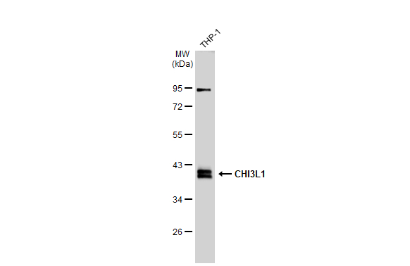 Whole cell extract (30 microg) was separated by 10% SDS-PAGE, and the membrane was blotted with CHI3L1 antibody (GTX135636) diluted at 1:1000. The HRP-conjugated anti-rabbit IgG antibody (GTX213110-01) was used to detect the primary antibody.