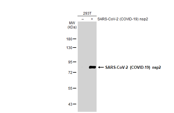Non-transfected (-) and transfected (+) 293T whole cell extracts (30 microg) were separated by 7.5% SDS-PAGE, and the membrane was blotted with SARS-CoV-2 (COVID-19) nsp2 antibody (GTX135717) diluted at 1:5000. The HRP-conjugated anti-rabbit IgG antibody (GTX213110-01) was used to detect the primary antibody.