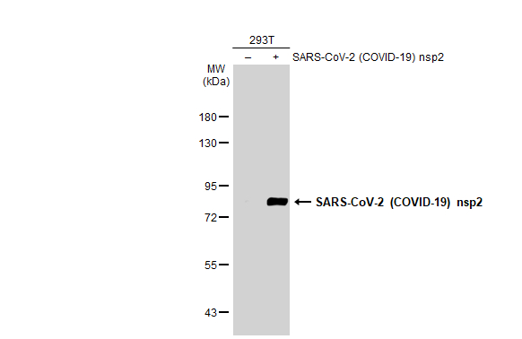 Non-transfected (–) and transfected (+) 293T whole cell extracts (30 μg) were separated by 7.5% SDS-PAGE, and the membrane was blotted with SARS-CoV-2 (COVID-19) nsp2 antibody (GTX135717) diluted at 1:5000. The HRP-conjugated anti-rabbit IgG antibody (GTX213110-01) was used to detect the primary antibody.
