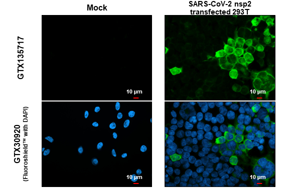 SARS-CoV-2 (COVID-19) nsp2 antibody detects SARS-CoV-2 (COVID-19) nsp2 protein at cytoplasm by immunofluorescent analysis. Sample: Mock and transfected transfected 293T cells were fixed in 4% paraformaldehyde at RT for 15 min. Green: SARS-CoV-2 (COVID-19) nsp2 stained by SARS-CoV-2 (COVID-19) nsp2 antibody (GTX135717) diluted at 1:2000.