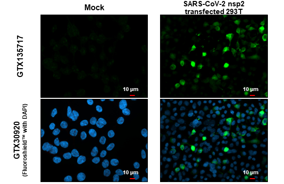 SARS-CoV-2 (COVID-19) nsp2 antibody detects SARS-CoV-2 (COVID-19) nsp2 protein at cytoplasm by immunofluorescent analysis. Sample: Mock and transfected transfected 293T cells were fixed in 4% paraformaldehyde at RT for 15 min. Green: SARS-CoV-2 (COVID-19) nsp2 stained by SARS-CoV-2 (COVID-19) nsp2 antibody (GTX135717) diluted at 1:2000.