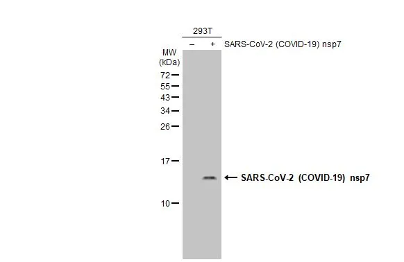 Non-transfected (-) and transfected (+) 293T whole cell extracts (30 microg) were separated by 15% SDS-PAGE, and the membrane was blotted with SARS-CoV-2 (COVID-19) nsp7 antibody (GTX135728) diluted at 1:1000. The HRP-conjugated anti-rabbit IgG antibody (GTX213110-01) was used to detect the primary antibody.