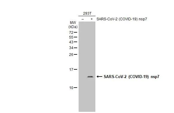 Non-transfected (–) and transfected (+) 293T whole cell extracts (30 μg) were separated by 15% SDS-PAGE, and the membrane was blotted with SARS-CoV-2 (COVID-19) nsp7 antibody (GTX135728) diluted at 1:1000. The HRP-conjugated anti-rabbit IgG antibody (GTX213110-01) was used to detect the primary antibody.